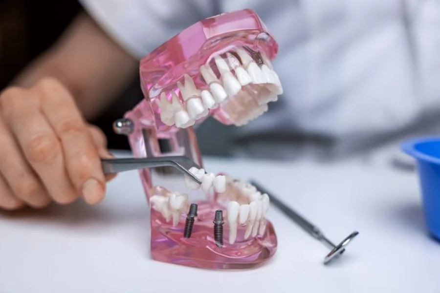 Dental Implants